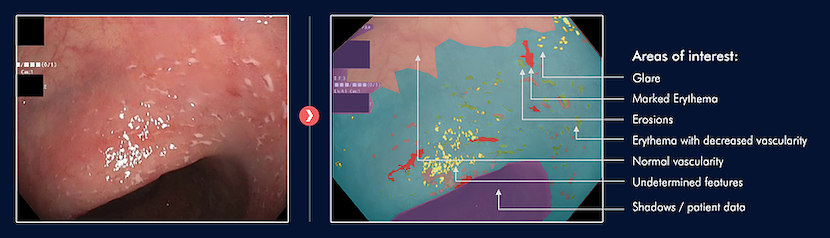 Boston-based Iterative Scopes raised $30M Series A