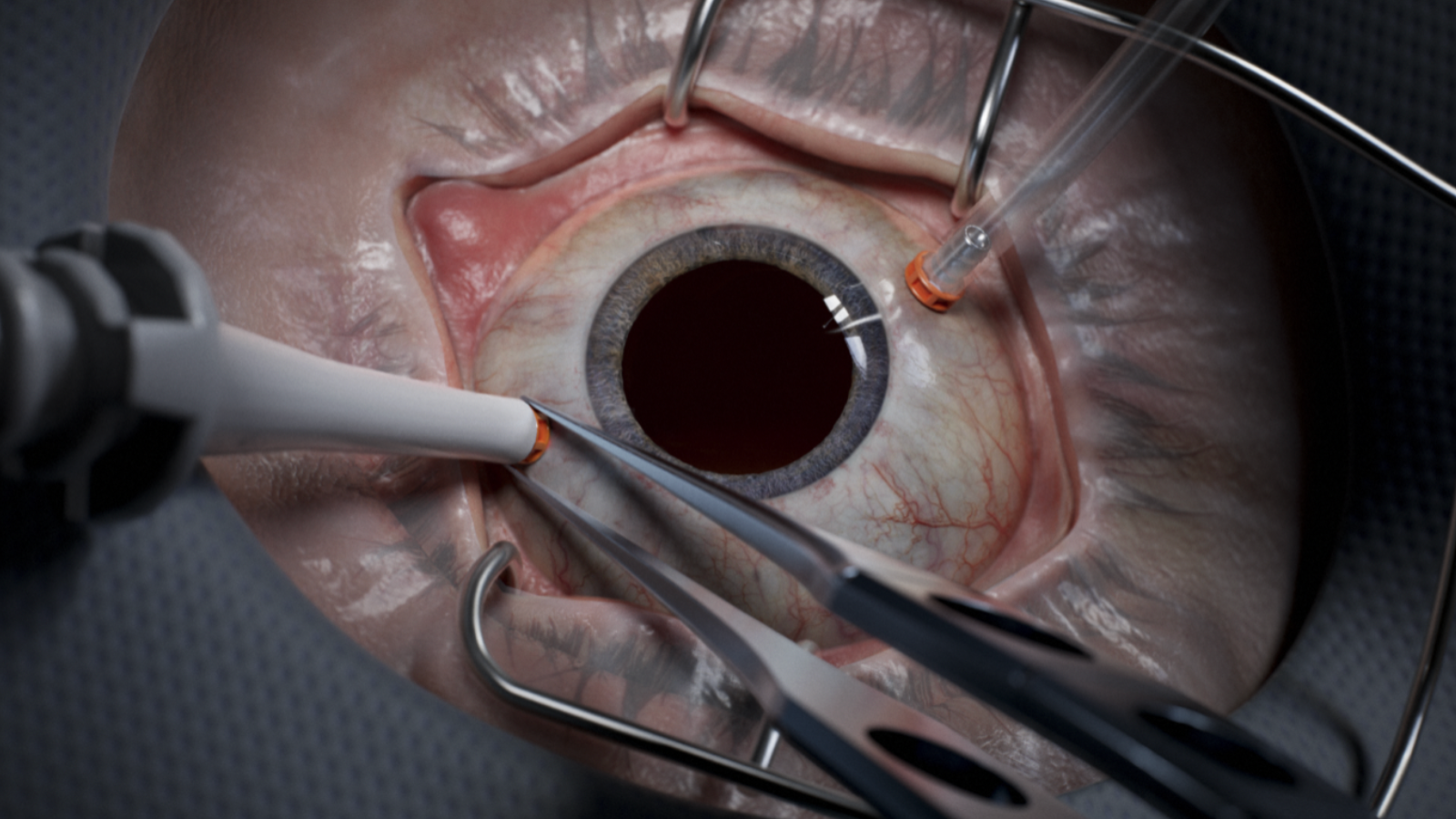 Animate eyeball receiving virtual reality surgery